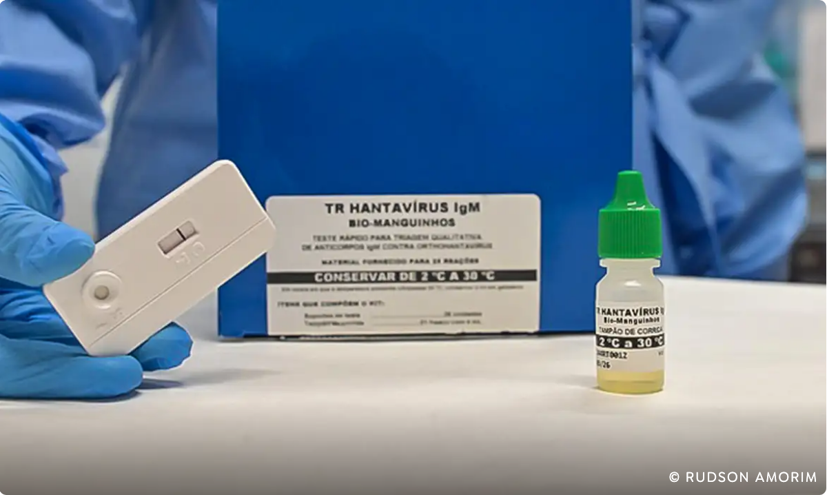 Novo teste faz diagnóstico de hantavirose em 20 minutos